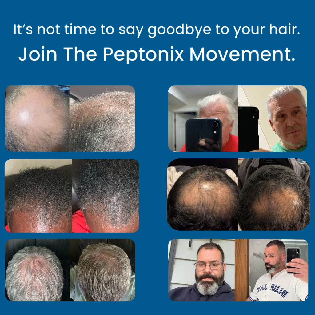 Micro-Infusion Peptide System For Hair Regrowth.